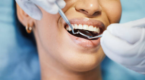 Best Emergency Tooth Extraction in Castlewood, VA