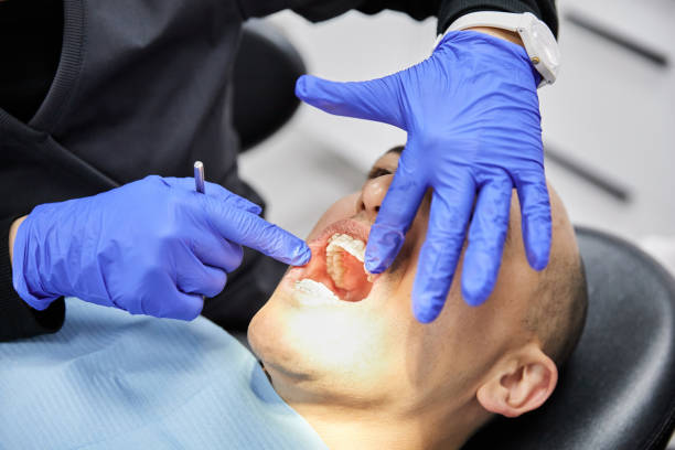 Best Emergency Treatment for Toothache in Castlewood, VA